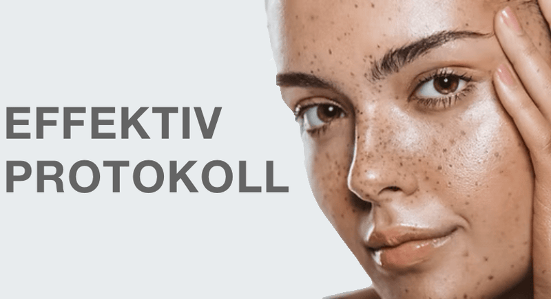Pigmentation, an effective protocol
